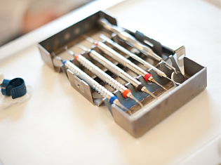 Behandlung von Parodontitis/Parodontose in der Zahnmedizin an der Musikhalle in Hamburgs City